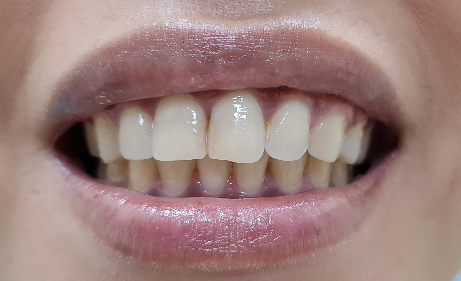 Before