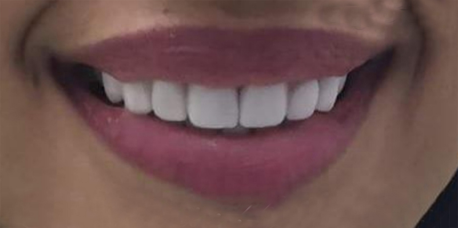 After